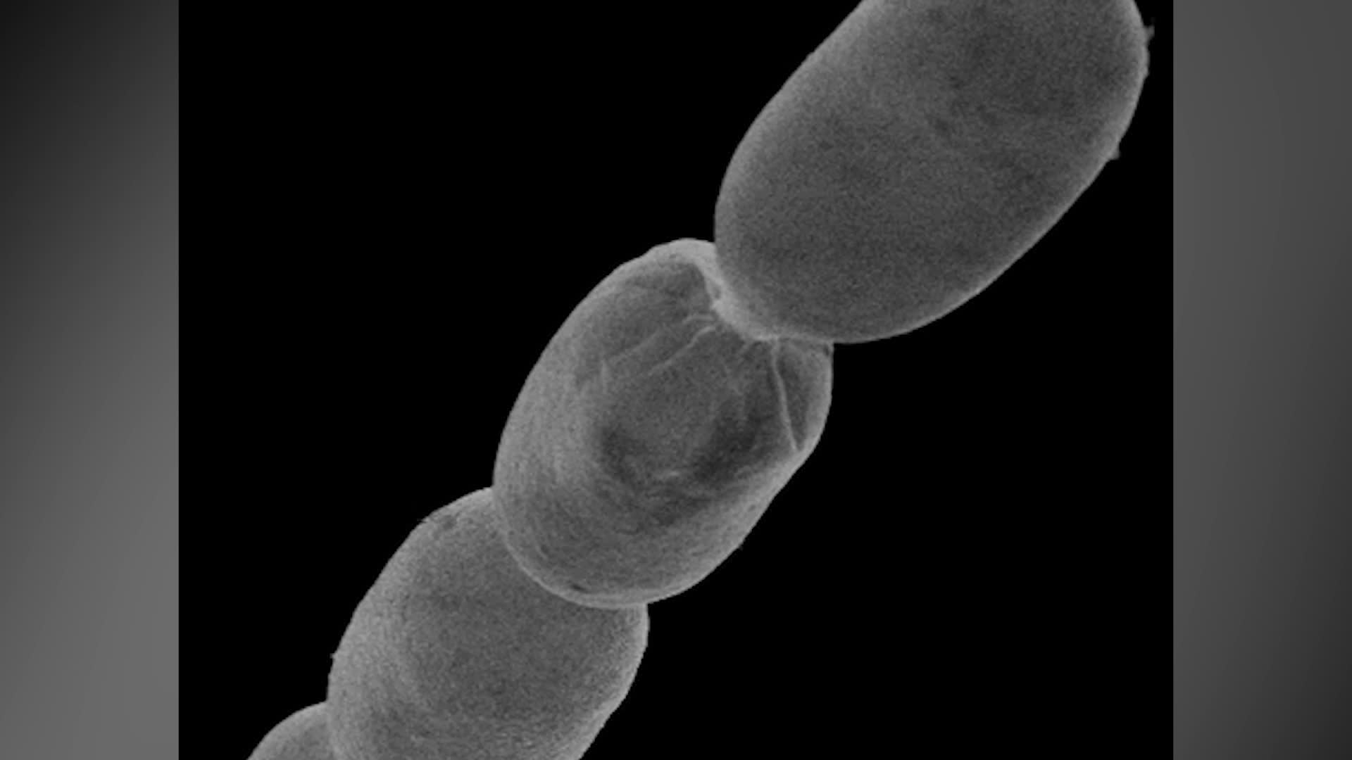 Bacterium You Can See With The Naked Eye Has Been Found