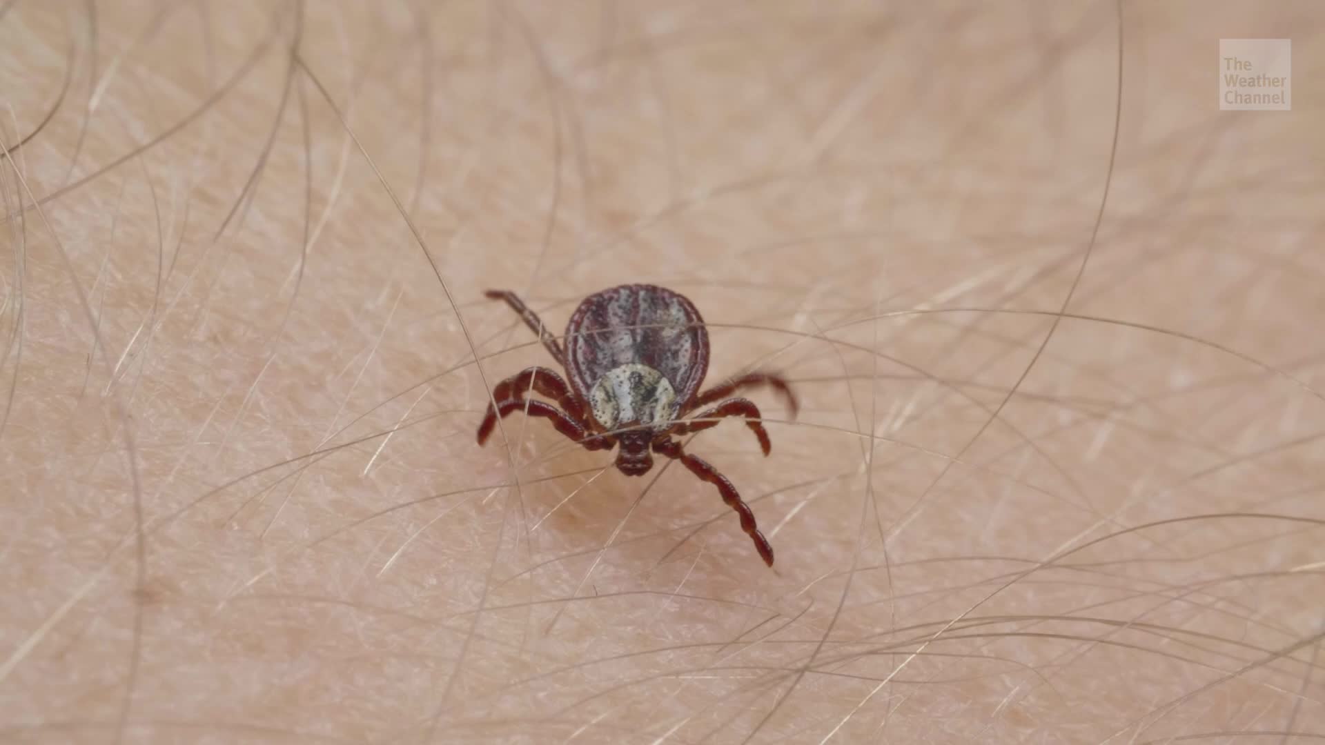 Why Lyme Disease Symptoms Persist For Some Videos from The Weather