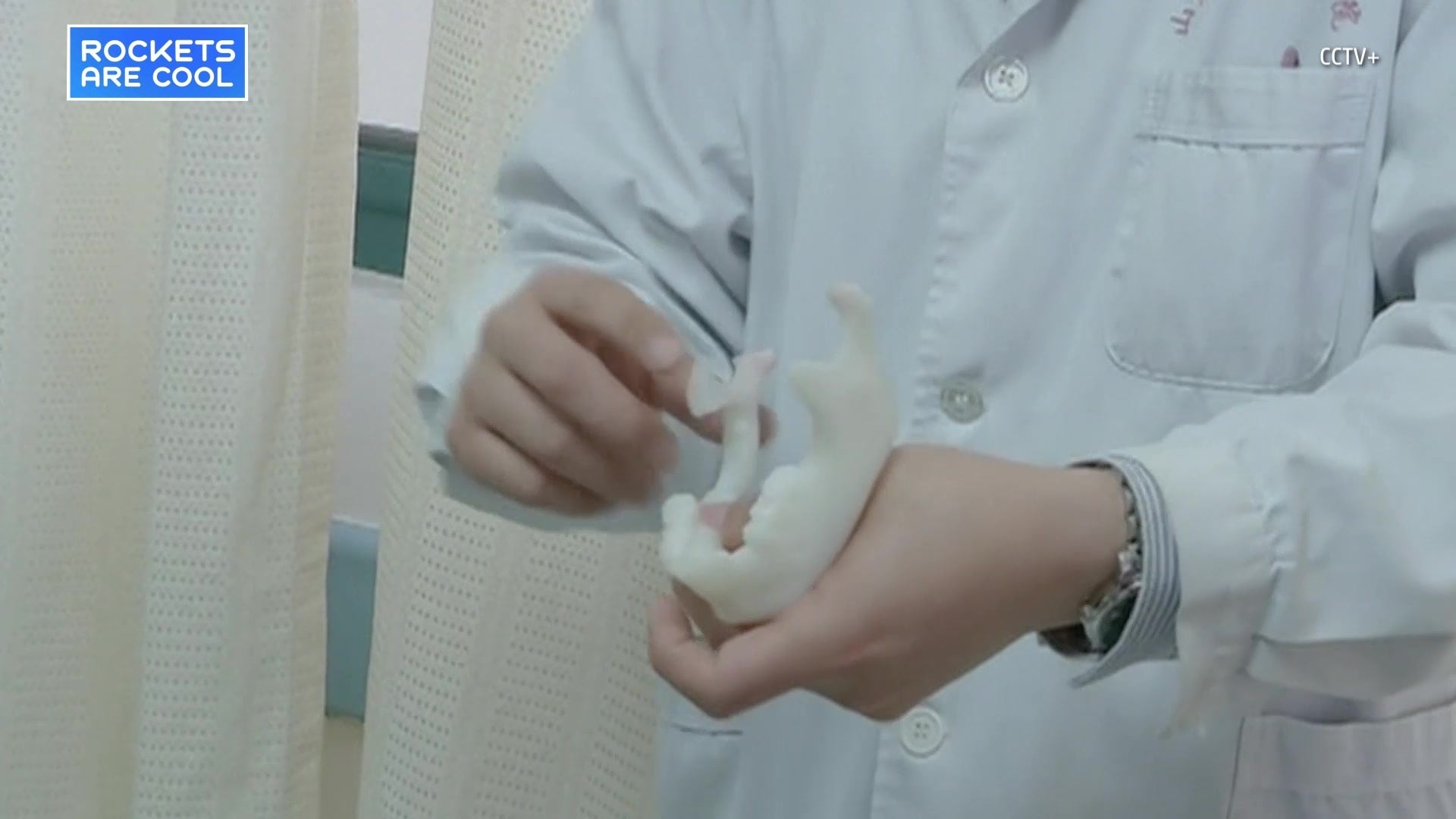 Boy Receives 3D Printed Jaw