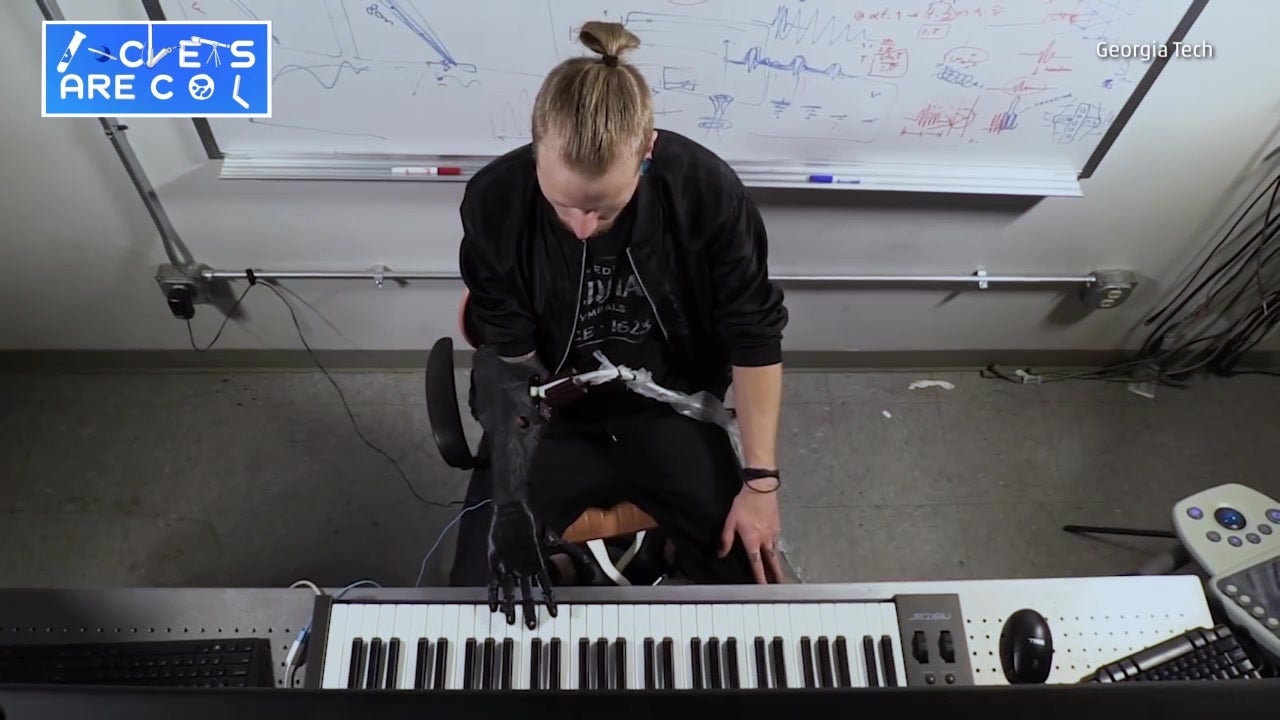 Luke Skywalker-Style Prosthetic Controls Hand