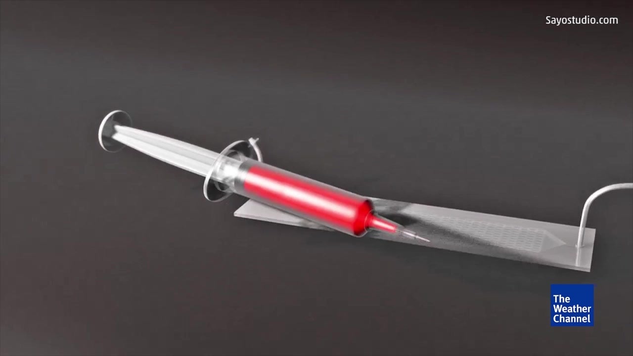 New Screening Device Detects Cancer Sooner