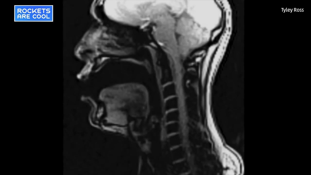 Vocologist Sings in an MRI