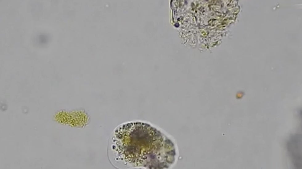 Study Finds Link Between Flint Water and Legionnaires&rsquo; Disease