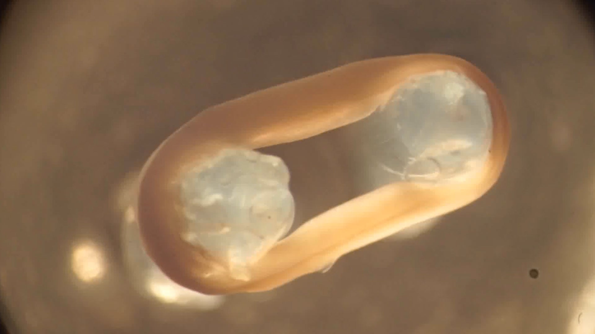 Breakthrough Could Cure Duchenne Muscular Dystrophy