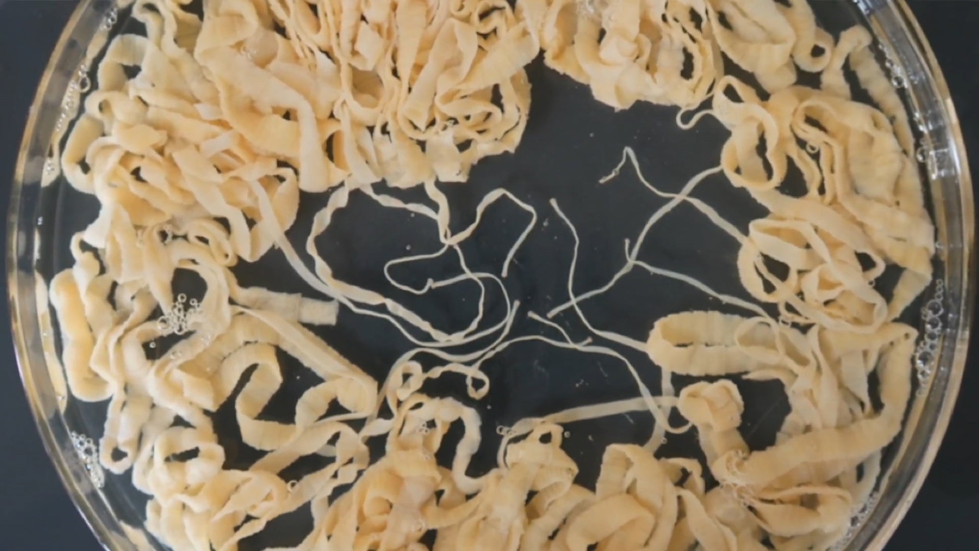 Kids Particularly Vulnerable To Deadly Parasite The Weather Channel